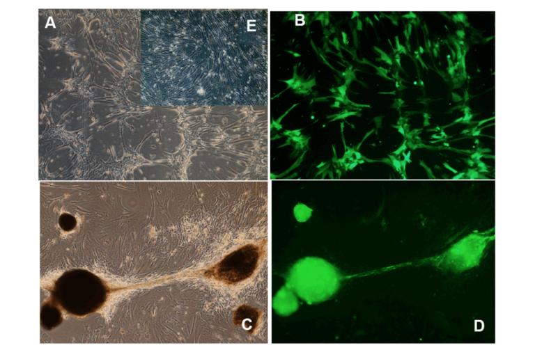 Figure 3. Morphological changes induced by long-term OSKM gene action in human umbilical cord perivascular cells (HUCPVC).