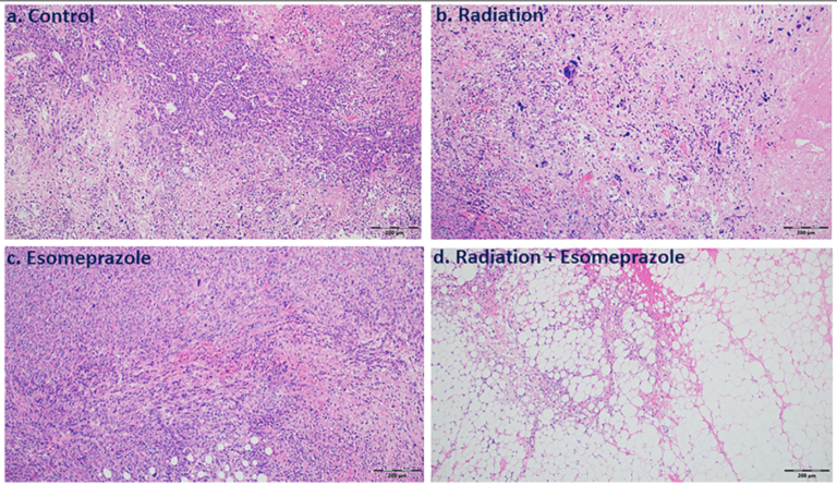 Figure 4: Combination of esomeprazole and radiation reduces cancer cell growth and proliferation.