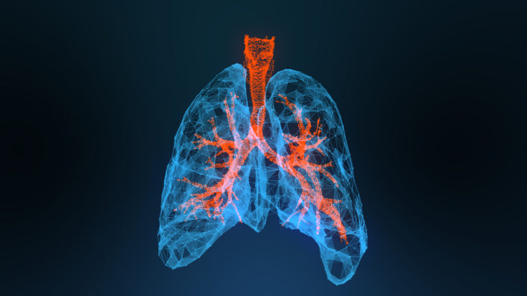 3d rendered illustration of lung cancer