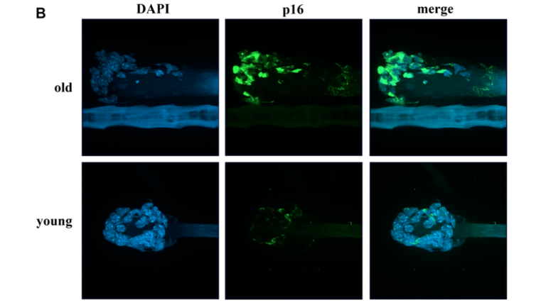 Figure 6. Markers of senescence analysis in hair follicular cells.