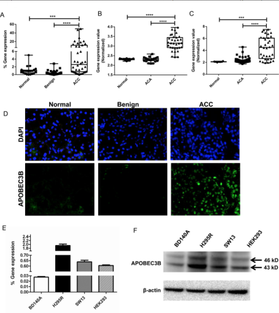 Figure 1: APOBEC3B expression in adrenocortical carcinoma