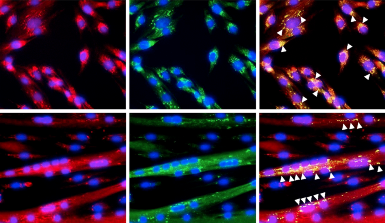 Immunofluorescence detection of GRSF1 (green) and mitochondria (red) in proliferating myoblasts and differentiating myotubes. Arrowheads indicate GRSF1 signals; n=3. Scale bar, 50 μm.