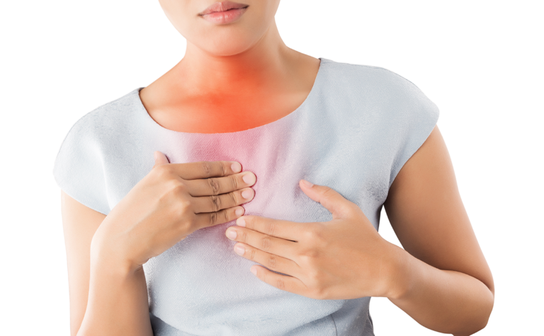 Heartburn Acid Reflux