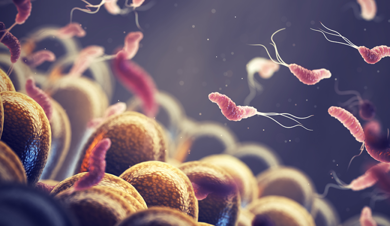 Common Bacteria Associated With Gastric Cancer and New Biomarkers