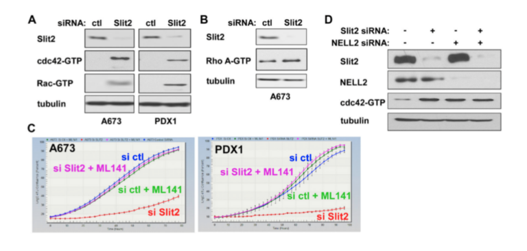 Figure 2: EWS::FLI1 binds to the Slit2 gene promoter in Ewing sarcoma cells.