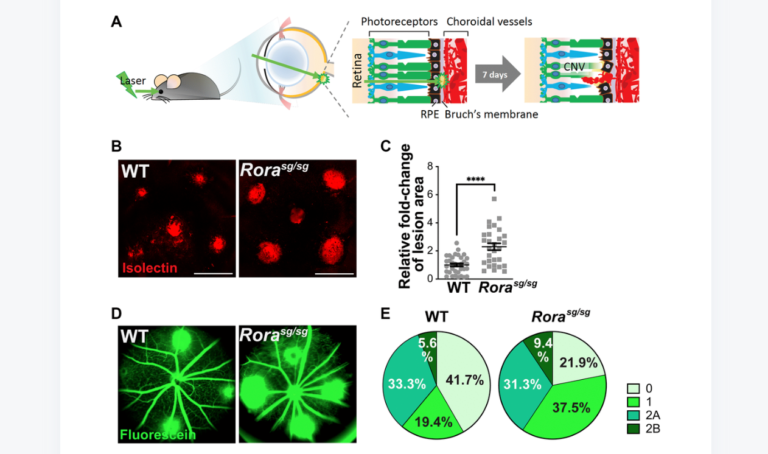 Figure 2. Genetic deficiency of RORα increased lesion size and vascular leakage in a mouse model of laser-induced choroidal neovascularization (CNV).