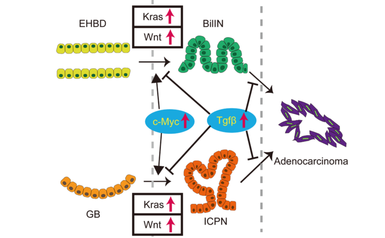 Figure 1: The role of Kras and canonical Wnt pathways for tumorigenesis of extrahepatic biliary system.