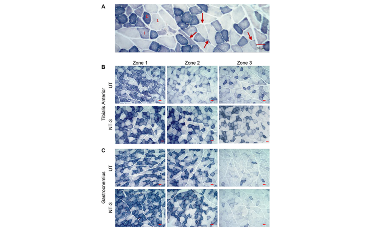 Figure 2. Muscle fiber size increase in aged C57BL/6 mice with AAV1.NT-3 gene therapy.
