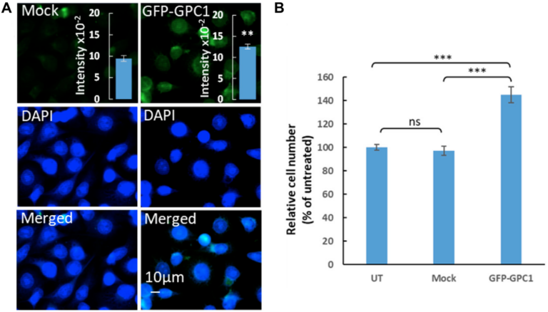 Figure 6: Overexpression of GPC1 increases proliferation of T24 cells.