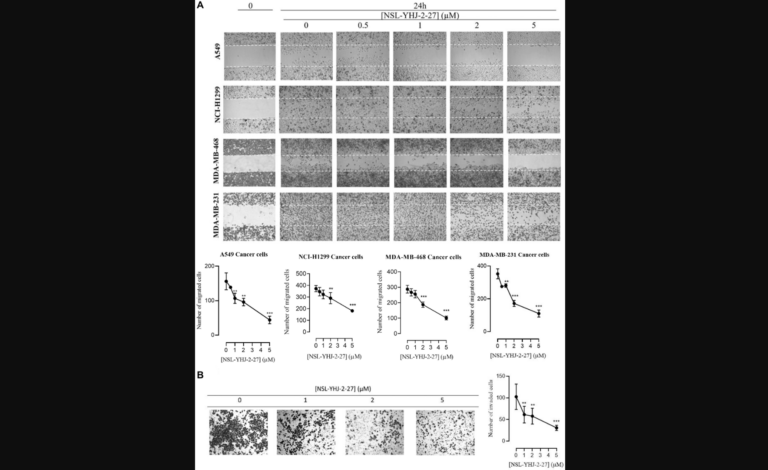 Figure 5: NSL-YHJ-2-27 suppresses cancer cell migration and invasion.