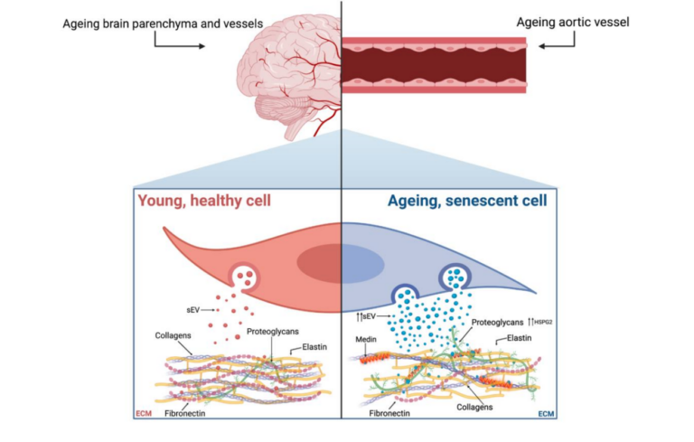 Figure 1. Proposed mechanism showing the parallels between age-associated brain and vascular amyloidosis, with both being mediated by sEVs and affected by cellular senescence.