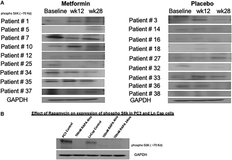 Figure 4: Variable changes in phosphorylation of S6 kinase 1 was observed in both cohorts. metformin