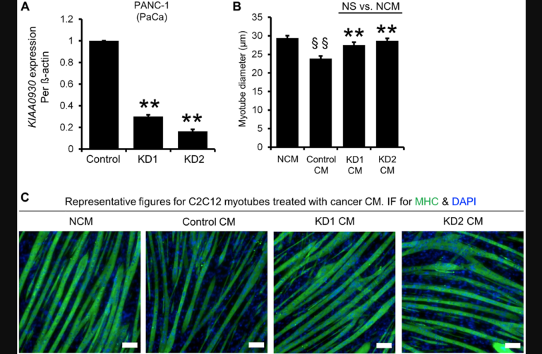 Figure 2: ShRNAs targeting KIAA0930 decrease KIAA0930 mRNA expression and suppress muscle atrophy in PANC-1 cells in vitro.