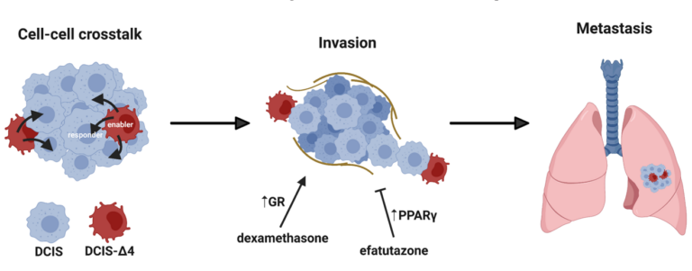 Figure 1: Graphical representation of AIB1Δ4 enabling DCIS invasion and metastasis.