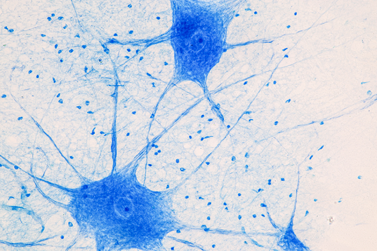 The Role of R-loops in Neuronal Aging