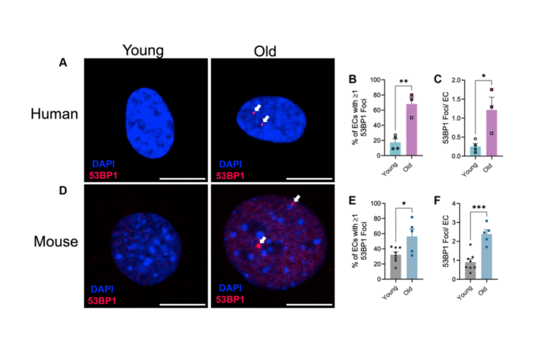 Figure 1. Effect of aging on endothelial cell DNA damage.