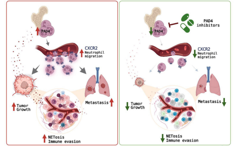 Figure 1: Mechanisms involved in regulation of tumor progression by neutrophil PAD4.