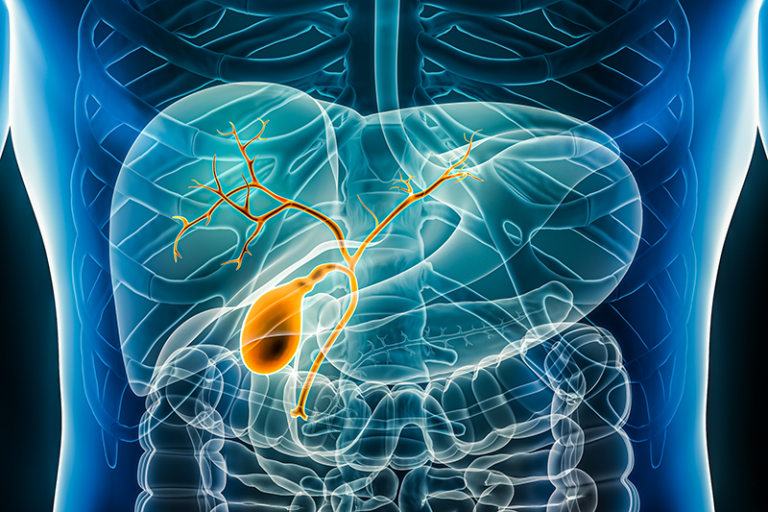 p53’s Protective Role in Extrahepatic Biliary Precancerous Lesions