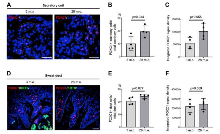 Figure 5. Expression changes of FOXC1 protein in old sweat glands.