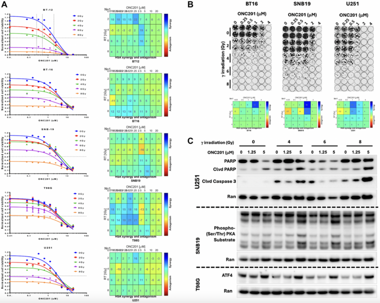 Triple Therapy Slows Glioblastoma Growth and Extends Survival in Preclinical Study