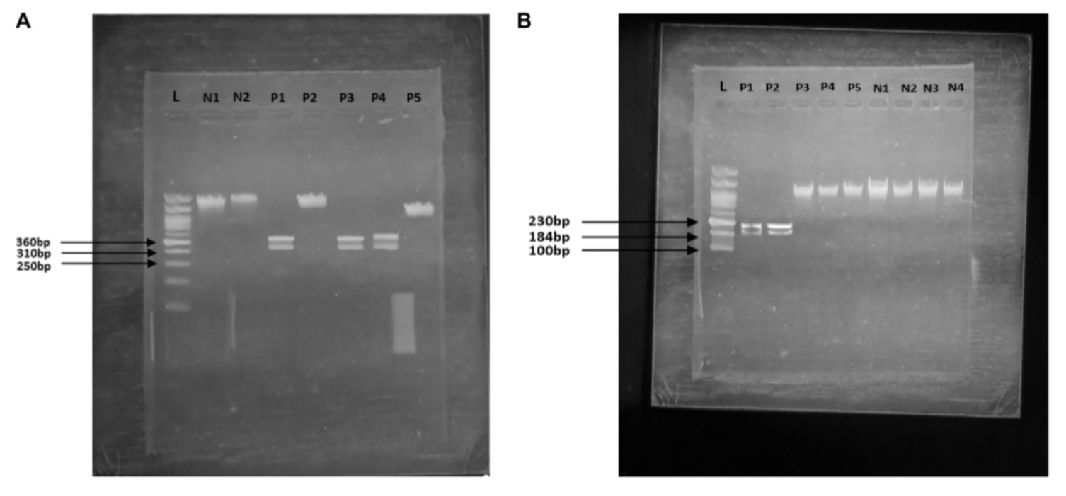 Genetic Testing Offers a Cost-Effective Tool for Early Prostate Cancer Detection