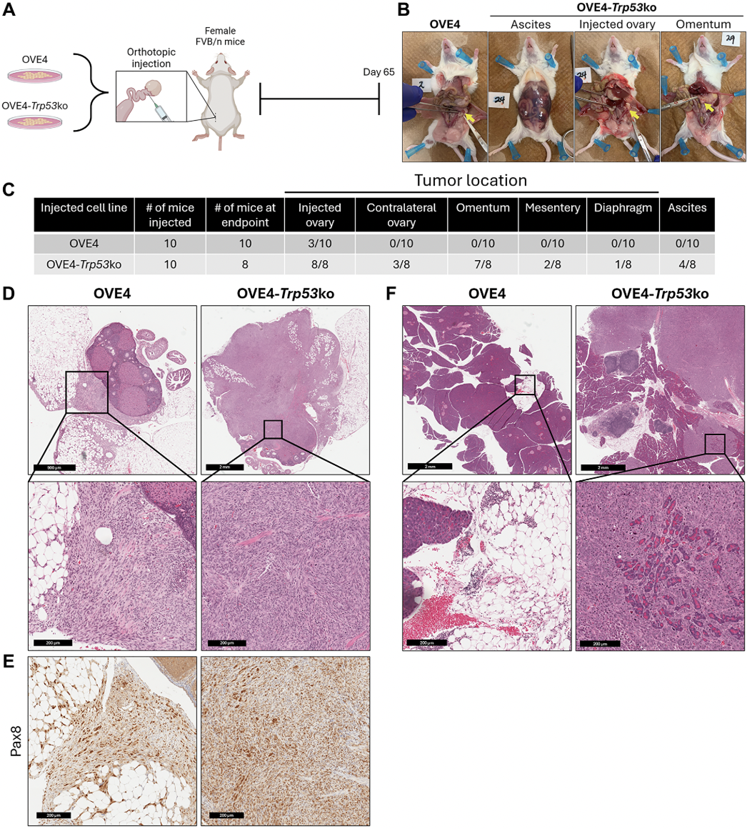 Loss of Trp53 Gene Promotes Tumor Growth and Immune Suppression in Ovarian Cancer