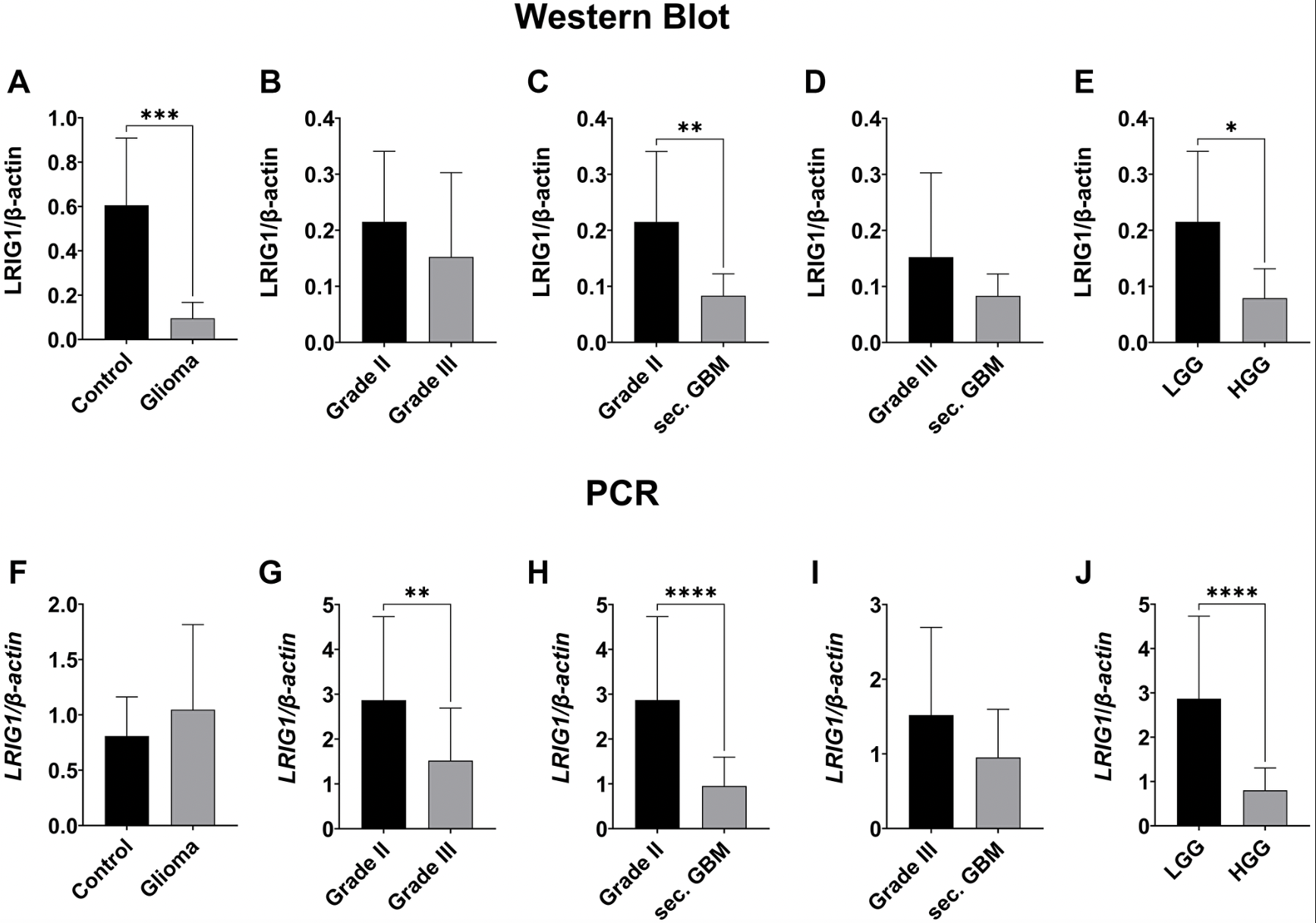 Lower LRIG1 Expression Linked to Aggressive Gliomas