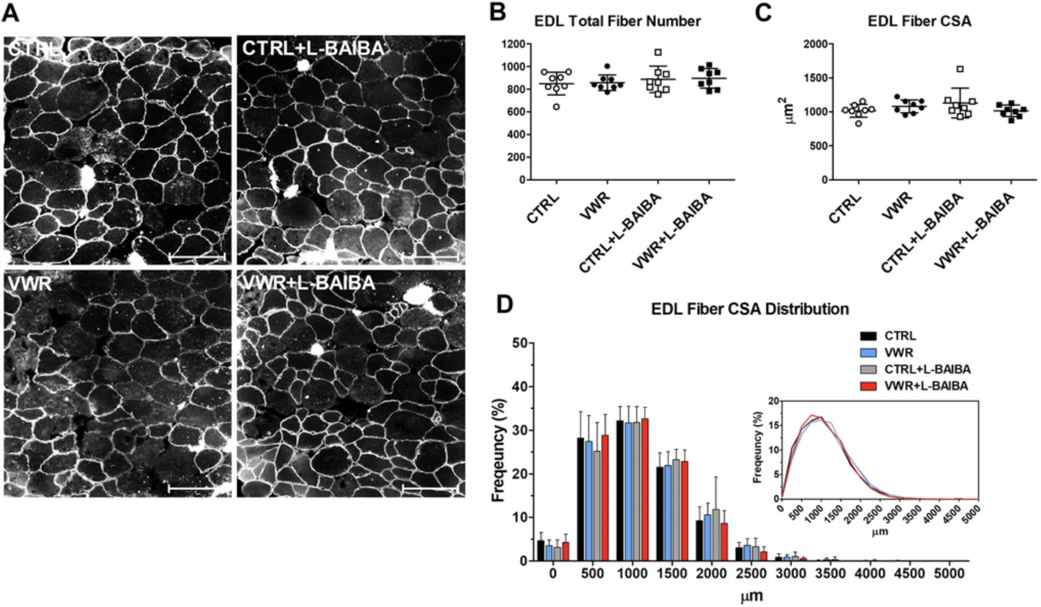 Exercise and L-BAIBA Supplement Boost Muscle and Bone Health in Aging Mice