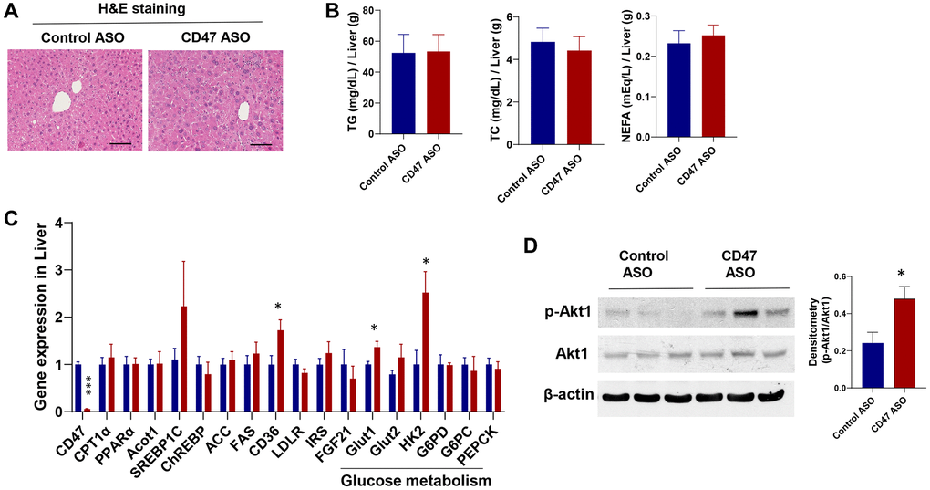 CD47 Antisense Therapy Improves Glucose Control and Lipid Balance in Aging Mice