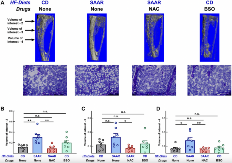 BSO Recapitulates Anti-Obesity Effects of Sulfur Amino Acid Restriction Without Bone Loss