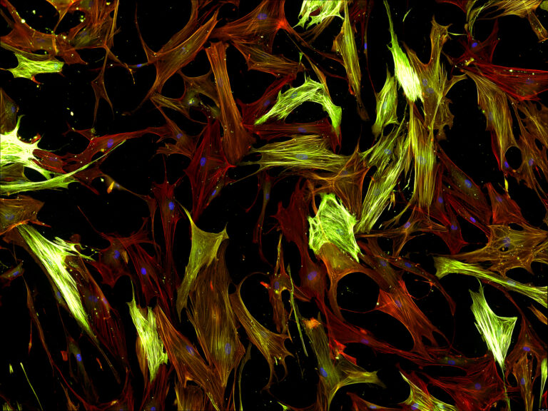 Real fluorescence microscopic view of human cells - human lung fibroblasts
