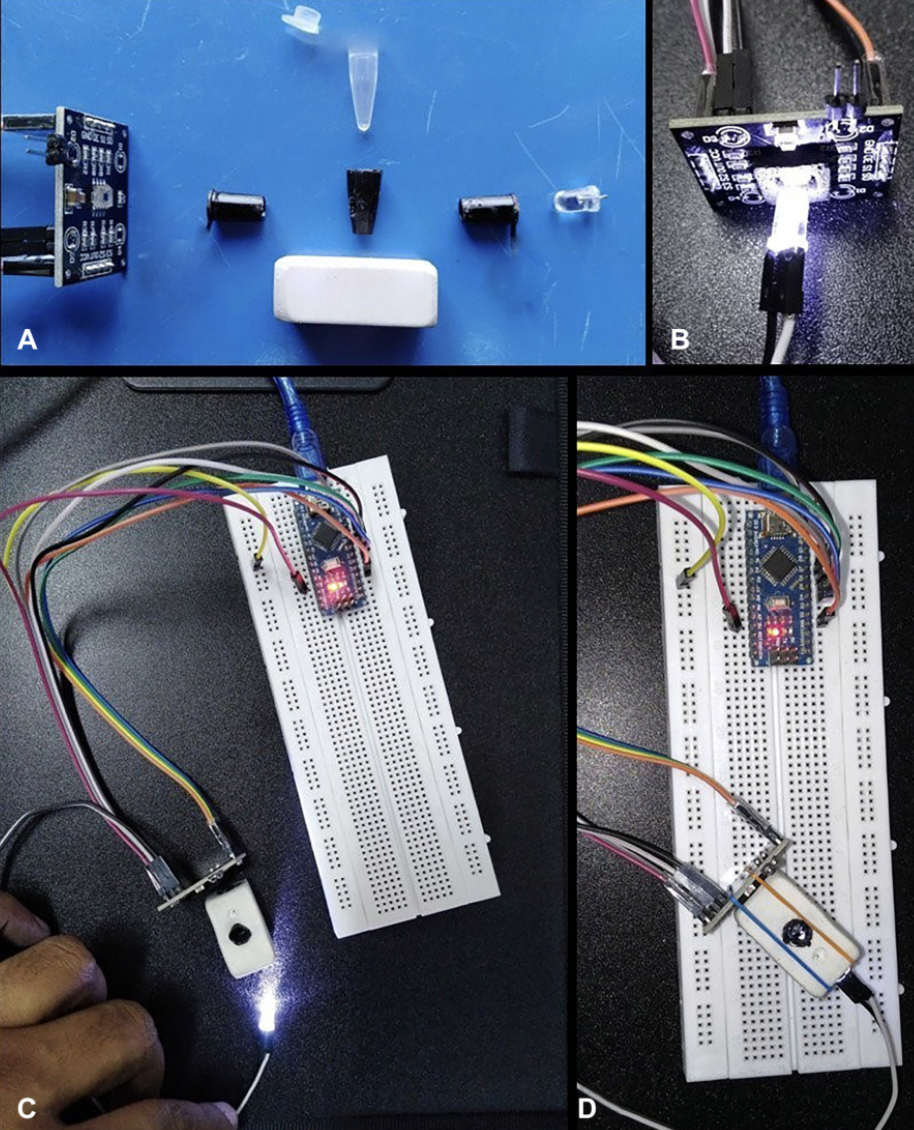 A low-cost color sensor device for rapid detection of high-grade serous ovarian carcinoma (HGSOC)