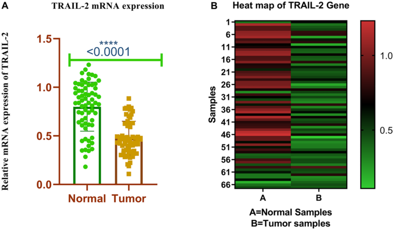 TRAIL-R2 Silencing Linked to More Aggressive Breast Cancer